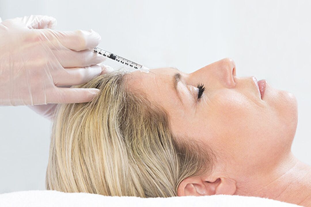 Plasmolifting is an injection method for rejuvenating facial skin