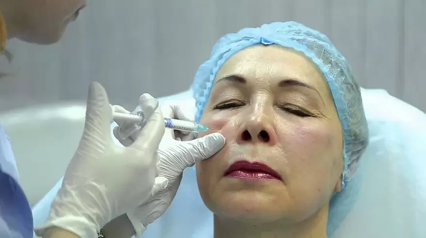 bioreforcement for facial rejuvenation